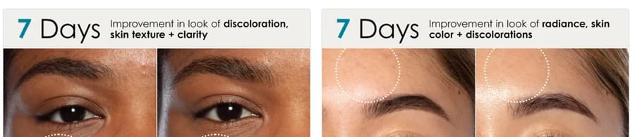 Sunday Riley — 7-day before and after, on the product page